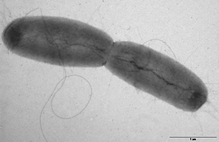 Darmbakteriums Escherichia coli E. coli